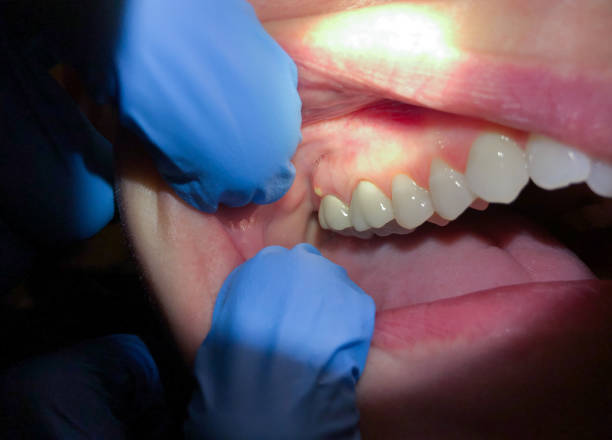 Best Pediatric Emergency Dentist in Jackpot, NV