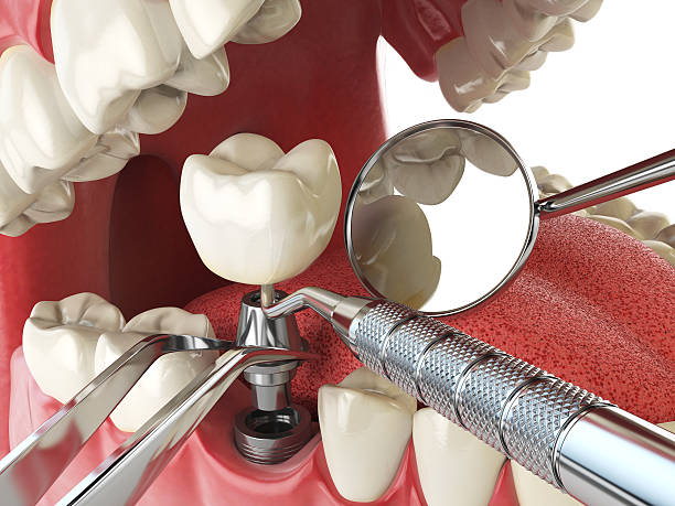 Best Urgent Care for Lost Fillings or Crowns in Jackpot, NV